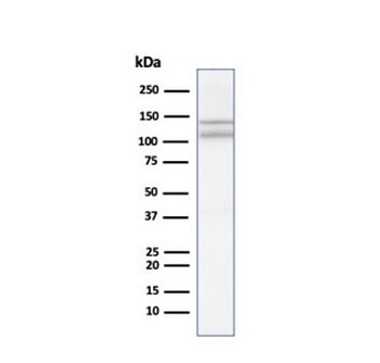N-Cadherin Antibody / CDH2