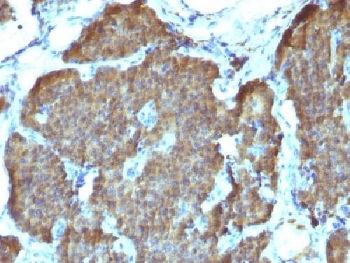 NSE Antibody / Neuron Specific Enolase