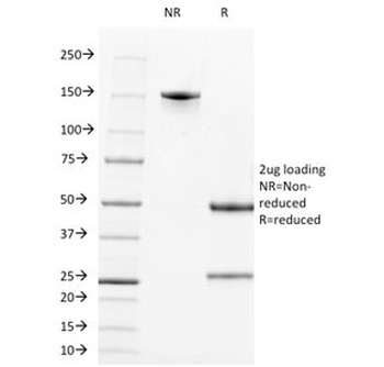 Tissue-nonspecific Alkaline Phosphatase Antibody / ALPL