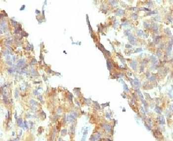 Alkaline Phosphatase Antibody / ALPL