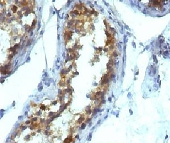Tissue-nonspecific Alkaline Phosphatase Antibody / ALPL