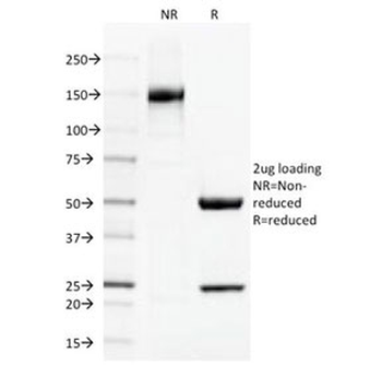 Thrombomodulin Antibody / CD141