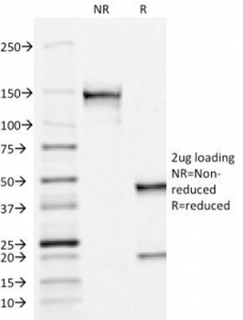 PSAP Antibody / Prostate Specific Acid Phosphatase