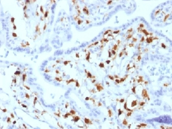 Factor XIIIa Antibody