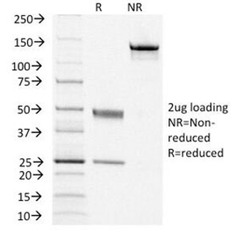 Thyroid Stimulating Hormone Receptor / TSHR Antibody (beta chain)