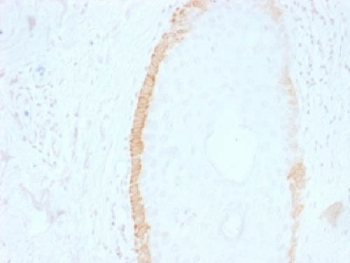 Cytokeratin 15 Antibody