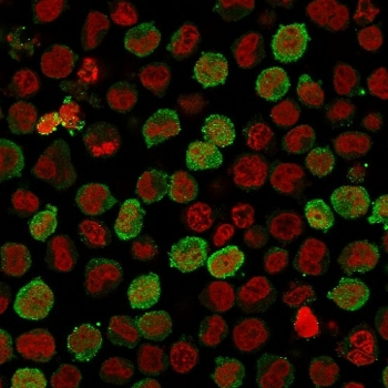 Calponin 1 Antibody