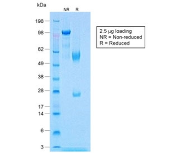 Calponin 1 Antibody
