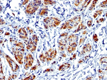 Caldesmon / CAD Antibody HMW
