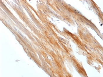 Caldesmon / CAD Antibody HMW