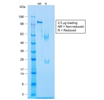 Caldesmon / CAD Antibody HMW