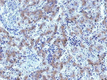 Glypican 3 Antibody / GPC3