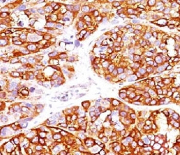 MART-1 / Melan-A Antibody