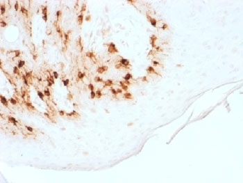 MART-1 / Melan-A Antibody