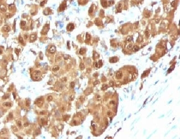 S100B Antibody