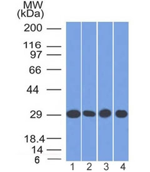 Prohibitin Antibody / PHB