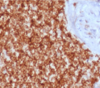 Bcl-2 Antibody