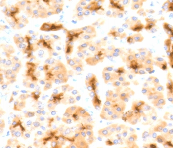 CFTR Antibody / Cystic Fibrosis Transmembrane Regulator