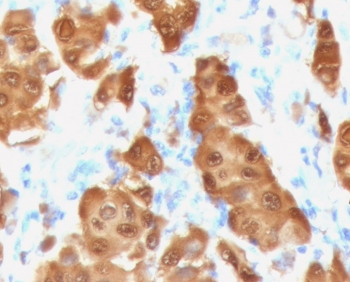 Recombinant S100B Antibody / Rabbit Monoclonal