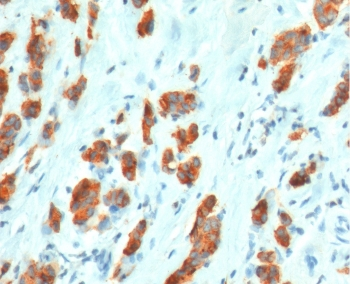 Recombinant MUC1 Antibody / Rabbit Monoclonal