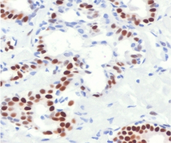 Recombinant Estrogen Receptor alpha Antibody