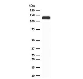 E-Cadherin Antibody / CDH1