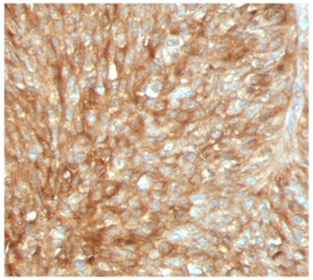 Recombinant Beta-2 Microglobulin Antibody