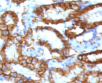 Cadherin 16 Antibody