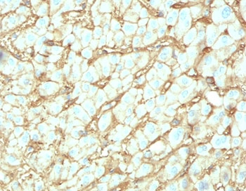 Albumin Antibody / Serum Albumin