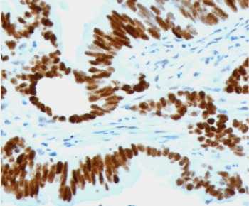p53 Antibody / TP53