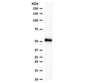 p53 Antibody / TP53