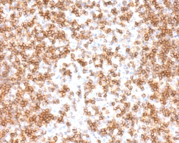 CD45 Antibody (Leukocyte marker)