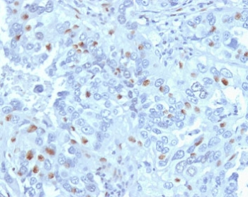 CCNA2 Antibody / Cyclin A2