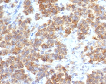TNFSF15 Antibody / VEGI / TL1A