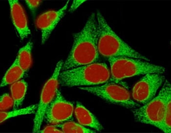 Calnexin Antibody