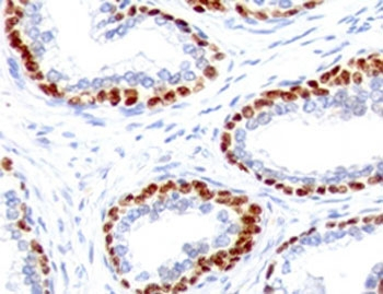 p63 Antibody / Tumor protein 63