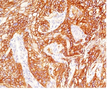 EGF Receptor / EGFR Antibody
