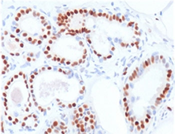 Estrogen Receptor alpha Antibody