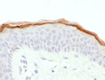 Filaggrin Antibody