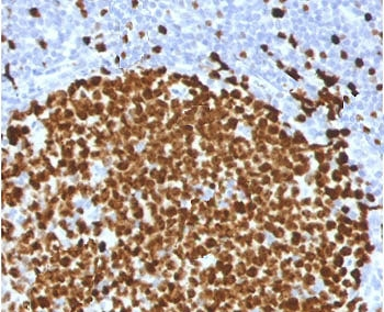 Ki67 Antibody