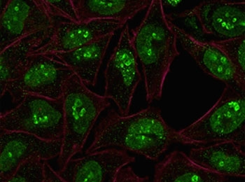 Ki67 Antibody