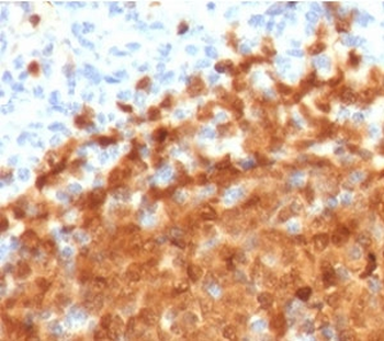 BOB1 Antibody