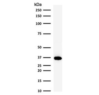 BOB1 Antibody