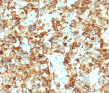 Melanoma gp100 Antibody / PMEL17