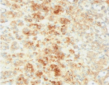 Adipophilin Antibody / Perilipin 2 / ADRP / PLIN2