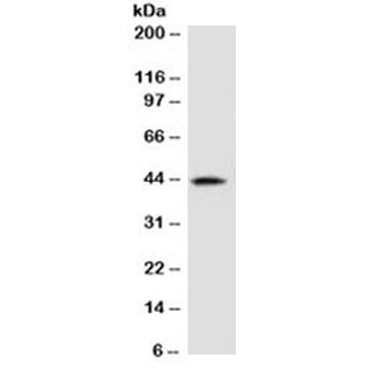 AMACR / p504S Antibody (Prostate Cancer Marker)