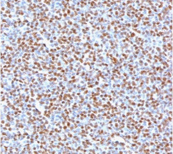 Recombinant ALK Antibody / Anaplastic Lymphoma Kinase