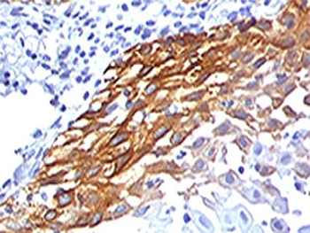 RPSA Antibody / 40S Ribosomal protein SA