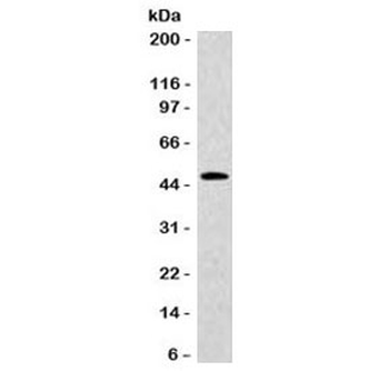 Cytokeratin 20 Antibody / CK20