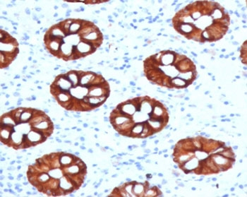Cytokeratin 20 Antibody / CK20